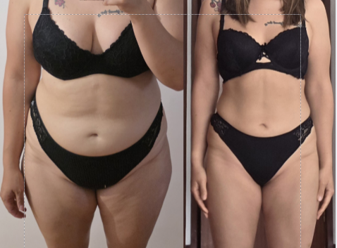 Antes e depois 1