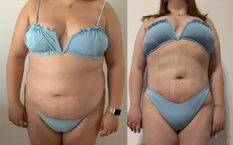 Antes e depois 3