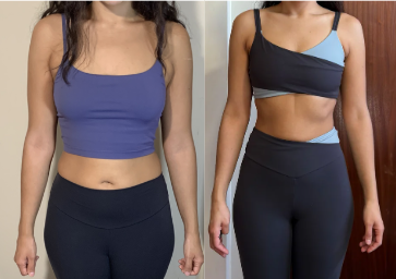 Antes e depois 4