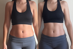Antes e depois 5