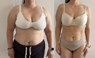 Antes e depois 6