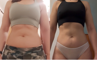Antes e depois 7