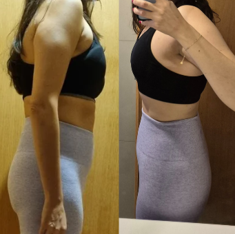 Antes e depois 9